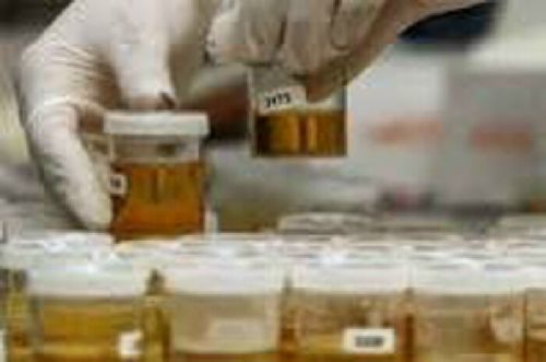Urine Pramugari Air Asia, Lion, Wings dan Garuda Juga Diperiksa