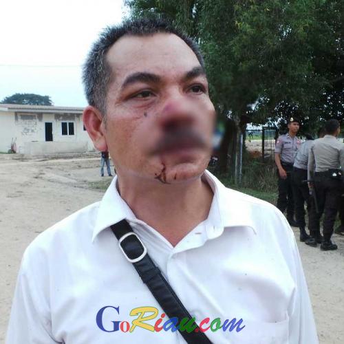 Kanit Reskrim Polsek Rumbai Pesisir Terluka Jadi Korban Bentrokan Puluhan OTK dan Satpol PP Pekanbaru