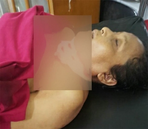 GoRiau Jenazah Dosen UMSU Medan yang Jadi Korban Pembunuhan Berada di RS Bhayangkara
