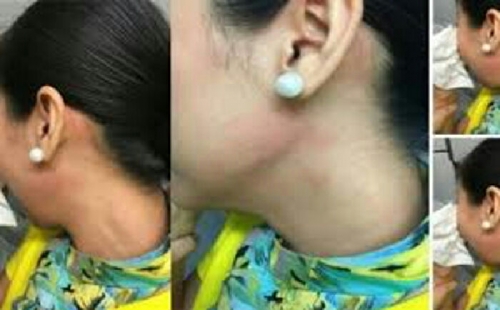 Pramugari Ditampar Penumpang Pesawat karena Menolak Bawakan Tas