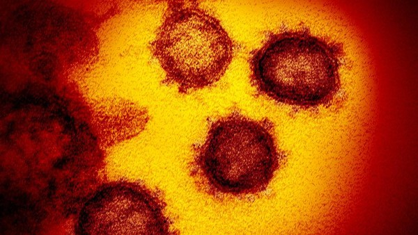 Ini 5 Gejala Bila Virus Corona Sudah Menginfeksi Paru-paru