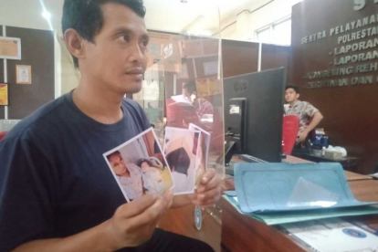 Jari Bayi 8 Bulan Terpotong Perawat di Palembang, RS Minta Maaf