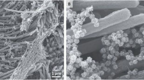 Peneliti Dapatkan Gambar Virus Corona Serang Sel Pernapasan Manusia, Begini Penampakannya