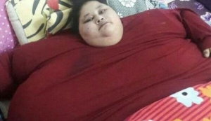 GoRiau Wanita Mesir Berbobot 500 Kg Akan Jalani Operasi Turunkan Berat Badan di India