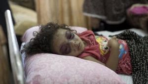 GoRiau Baru Saja Gencatan Senjata Berakhir, Israel Langsung Bunuh dan Lukai 7 Anak-anak Gaza