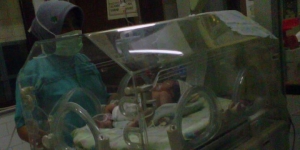 GoRiau Bayi Perempuan Berkepala 2 Lahir di Gresik, Ini Penjelasan Dokter