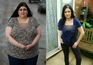 GoRiau Wanita Ini Mendadak Super Gemuk, dalam 6 Bulan Berat Tubuhnya Bertambah 51 Kg, Ini Fotonya