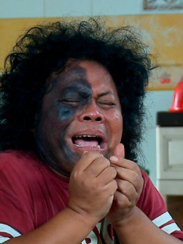 Selain Paru-paru Basah, Budi Anduk Juga Idap Kanker