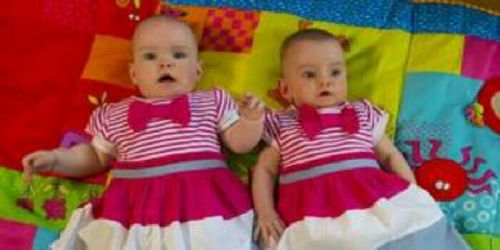 Ajaib, Meski Kembar, 2 Bayi Ini Kelahirannya Berjarak 2 Bulan