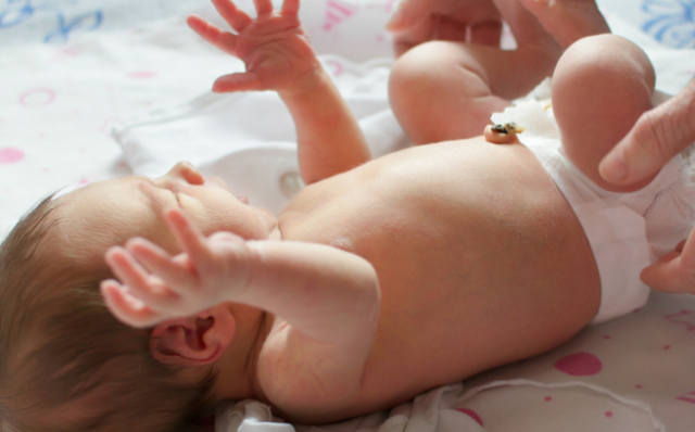 Bayi Rentan Idap Hernia, Ini Penyebab, Gejala dan Cara Mengatasinya