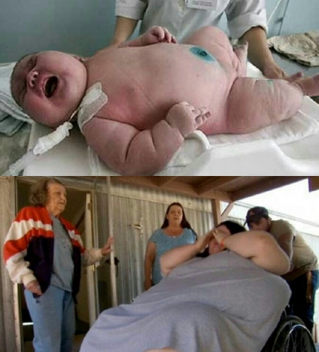 Wow, Wanita Berbobot 272 Kg Lahirkan Bayi Raksasa Seberat 18 Kg