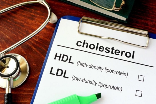 Kolesterol Tinggi Juga Serang Orang Kurus, Ini Penyebab dan Cara Mengatasinya