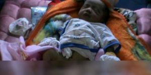 GoRiau Heboh, Bayi Berkepala Dua Lahir di Bengkulu