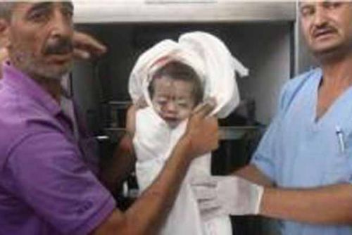 Dokter Jerman di Gaza: Israel Gunakan Senjata Kimia, Luka Korban Sangat Mengerikan, Semua Organ Tubuh Rusak