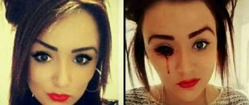 Kasihan Gadis Cantik Ini, Darah Mengalir dari Mata, Hidung dan Telinganya 5 Kali Sehari