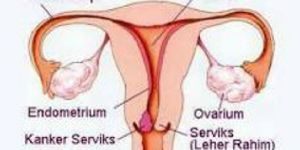 GoRiau Mengerikan, Satu Wanita Meninggal Tiap 2 Menit Akibat Kanker Leher Rahim