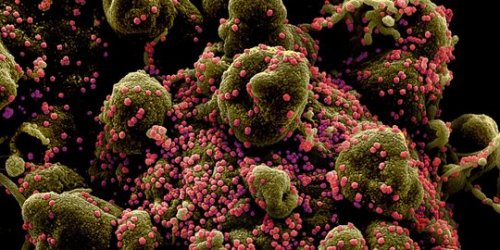 Hasil Penelitian, Virus Corona Berkembang 10 Kali Lipat dalam 3 Hari dan Bisa Menginfeksi Otak