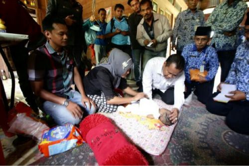 Akhirnya, Bayi Penderita Penyakit Penyumbatan Saluran Empedu Dirujuk ke RSCM Jakarta