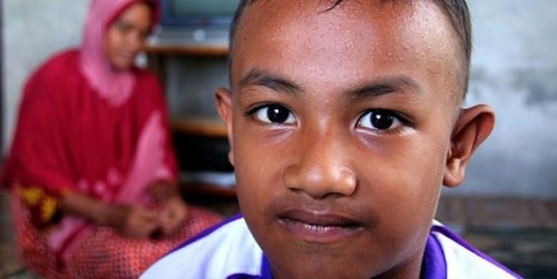 Kelainan Hormon, Bocah Usia 5 Tahun di Aceh Barat Sudah Berkumis dan Brewokan
