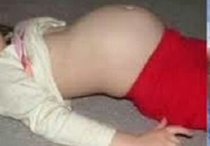 GoRiau Mengeluh Sakit Perut di Sekolah, Bocah 10 Tahun Melahirkan Bayi Secara Normal