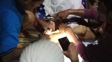 Disambar Petir Saat Nonton Sepakbola di Bogor, 1 Tewas dan 7 Orang Luka-luka
