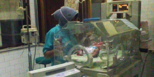 GoRiau Bayi Berkepala 2 di Gresik Meninggal karena Kebocoran Jantung