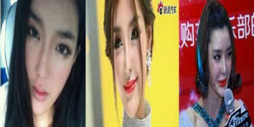 Operasi Plastik Kadaluarsa, Wajah Super Model China Ini Berubah Mengerikan