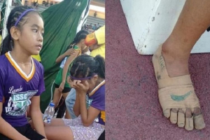 GoRiau Luar Biasa, Kakinya Hanya Dibalut Plester Perban Saat Lomba Lari, Siswi SD Ini Sabet 3 Medali Emas