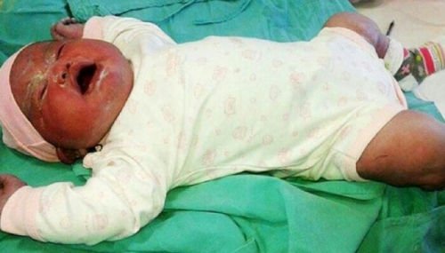 Bayi Raksasa Lahir di Argentina, Ini Fotonya