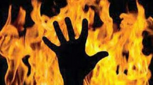 GoRiau Bocah Kelas I SD di Sumbar Dibakar Sepulang Sekolah, Ternyata Korban Salah Sasaran Dendam Istri Muda