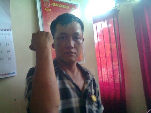 Liput Kunjungan Wabup ke PT TPP, 1 Orang Wartawan Dipukuli Karyawan