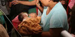 GoRiau Bayi Memiliki 2 Kepala Lahir di Langkat