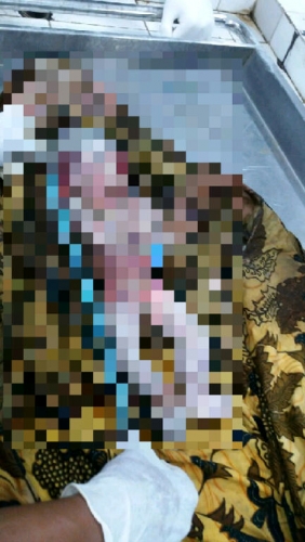Begini Kondisi Bayi Malang yang Sengaja Dikubur di Depan Rumah Warga Tenayan Raya Pekanbaru
