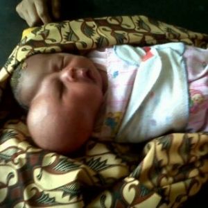 GoRiau Kasihan, Bayi Ini Miliki 2 Kepala, Butuh Bantuan Biaya Operasi