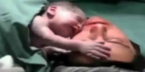 Ajaib, Bayi Baru Lahir Peluk dan Cium Wajah Ibunya