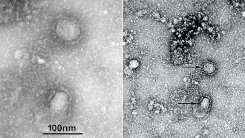 Ilmuwan NMDC Publikasikan Virus Corona, Begini Penampakannya