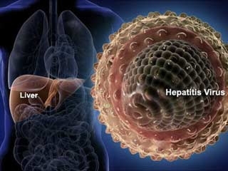 Wanita Muda Berusia 16 Tahun Ini Didiagnosa Menderita Hepatitis, Rupanya Ini Penyebabnya