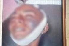 Taruna Pelayaran di Aceh Besar Meninggal Saat Ospek, Keluarga Temukan Lebam