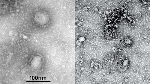 Virus Corona Sudah Renggut 132 Jiwa di China dan 5.974 Orang Terinfeksi