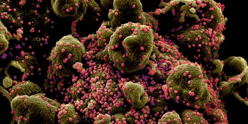 Ilmuwan Australia Yakin Virus Corona Dibuat di Laboratorium, Ini Sejumlah Alasannya