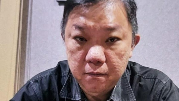 Bareskrim Polri Buru Bos New Zone Medan Terkait Kasus Narkoba